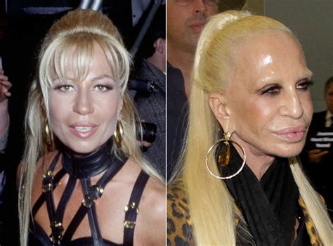 madame versace chirurgie|donatella versace pictures.